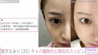 愛沢えみり、キャバ嬢時代と現在のスッピン比較写真&美容整形の