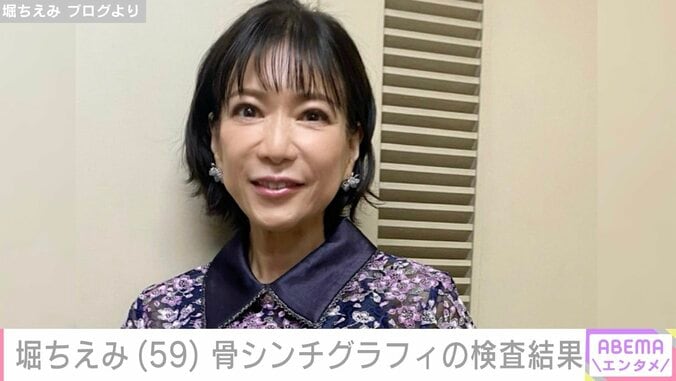 【写真・画像】2019年に舌がん公表・堀ちえみ（59）、骨シンチグラフィの検査結果を報告「リウマチのお薬が増えました」　1枚目