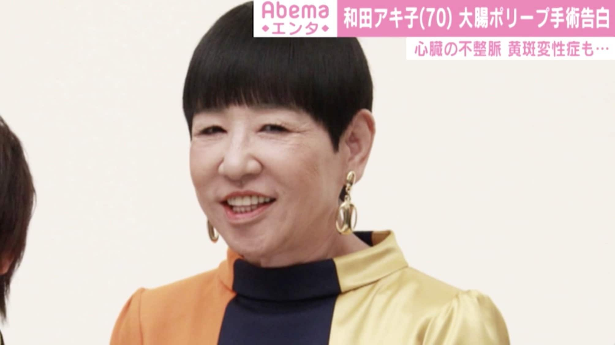 和田アキ子 大腸ポリープの手術を告白 心室期外収縮 黄斑変性症も 芸能 Abema Times