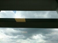 大島康徳『入院しました』