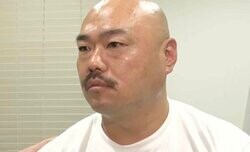 クロちゃん、美容医療で小顔化「え？誰？このカッコいい人？」変化に驚き