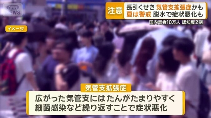 気管支拡張症とは