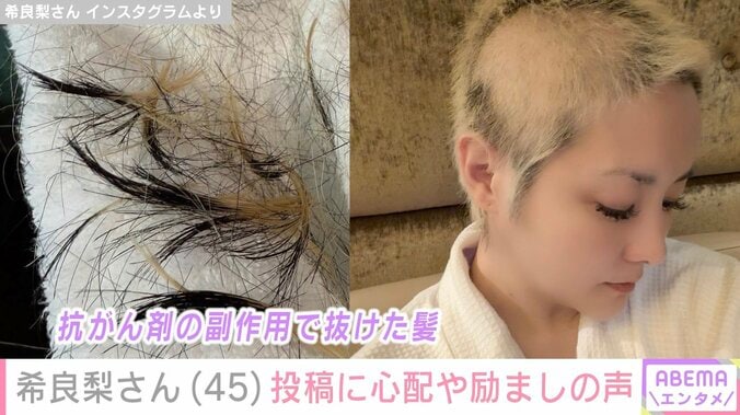 “GTO出演俳優”がん闘病中の希良梨さん（45）、副作用で歯が抜けたことや検査結果への不安つづる「助けてください」 3枚目