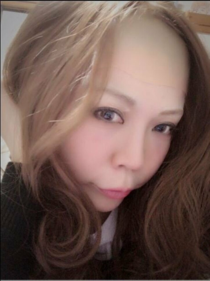 安室奈美恵のものまねポイントを解説 スーパーハゲヅラ 活用 話題 Abema Times