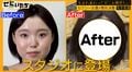 総額500万以上で顔面フル整形したセクシー女優、衝撃のビフォーアフターにかまいたちに驚き
