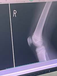 ダイアモンド☆ユカイ『俺の頼音』