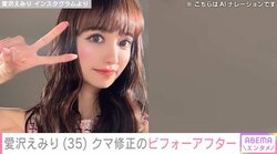 元キャバ嬢・愛沢えみり、目の下のクマを修正したビフォーアフターを披露 「若返った、くぼみがなくなったと言われます！」