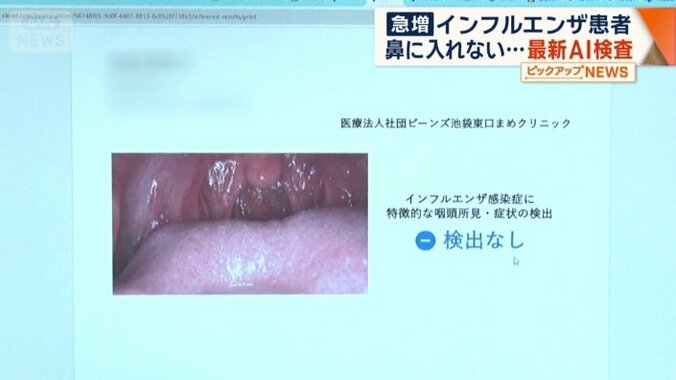 数十秒で検査結果が判明