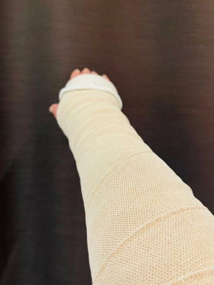  だいたひかる、浮腫の治療の為の包帯生活が始まることを明かす「心配されそうな見た目となりますが」 