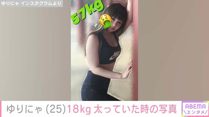 【写真・画像】減量ビフォアフが話題・ゆりにゃ、今よりも18kg太っていた頃の写真公開「注射ごときでゆりかの体形には絶対なれないよ〜ん」　2枚目