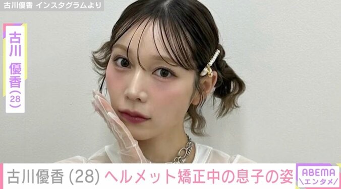 【写真・画像】古川優香（28）「レベル3の重症」ヘルメット矯正中の息子の最新ショットを公開　1枚目