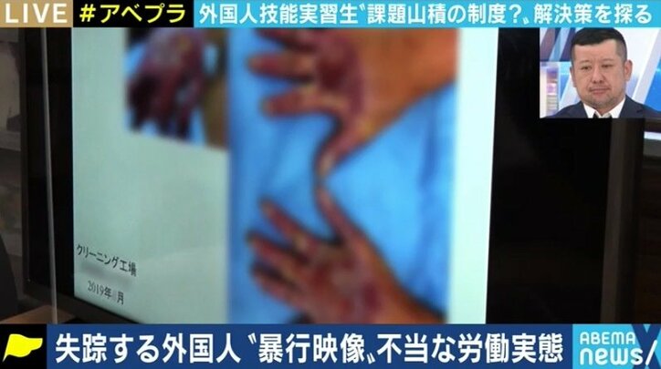 冬のカニ漁にも影響…? 浮き彫りになる技能実習生の“不在”、コロナ禍を劣悪な外国人技能実習制度の見直しの機会に