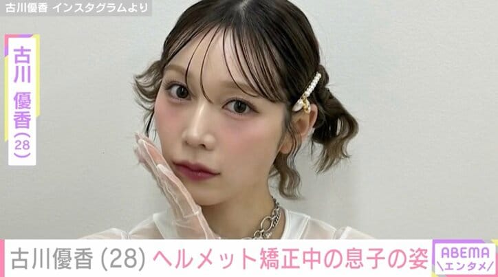 【写真・画像】古川優香（28）「レベル3の重症」ヘルメット矯正中の息子の最新ショットを公開　1枚目