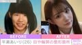 “整形総額2400万円”BreakingDownラウンドガール平瀬あいり、目や輪郭の整形箇所公開「クマ取り・二重形成・目尻切開・タレ目形成…」