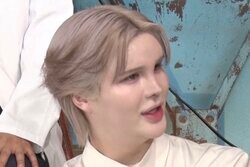 「総額200万円」Matt、おでこに注入したヒアルロン酸について語る「羊の精子に近いもの」