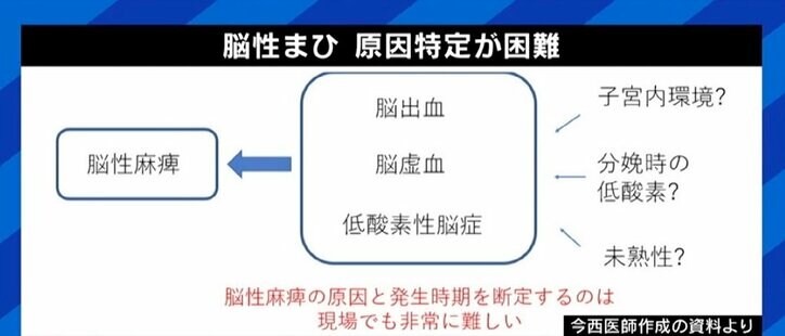 「子どもの成長が楽しみではなく恐怖」 脳性まひ児補償、制度改定も抜け落ちる子が 当事者が課題訴え 1枚目