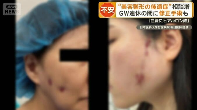 美容後遺症外来を受診するケース