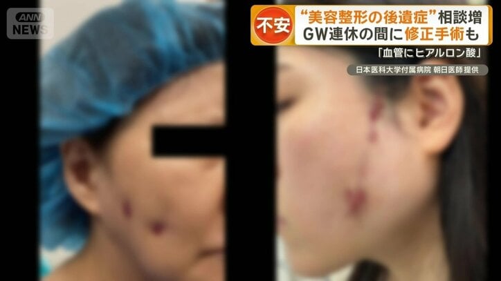 美容後遺症外来を受診するケース