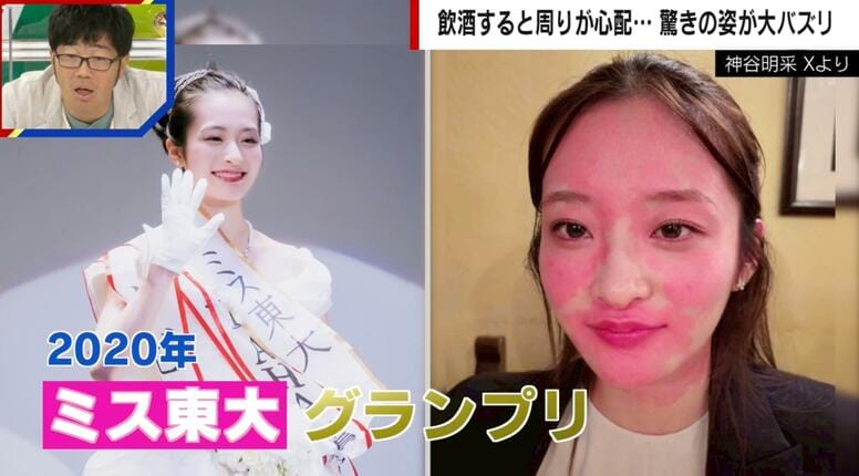 ミス東大・神谷明采、ビール1杯で顔がまだらに赤く変色…「母親に好きな人の前では飲むなと言われている」
