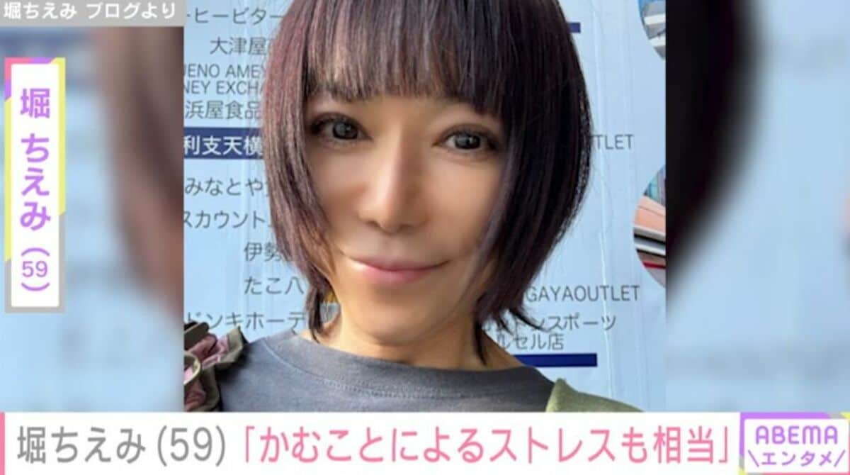 舌がんのため6割切除”堀ちえみ（59）「舌が普通ではない分 かむこと