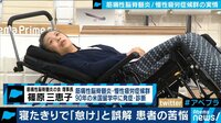 “怠け”と誤解され…寝たきりの患者の苦悩