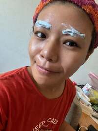 クロ『舌下治療1年間を終えて。』