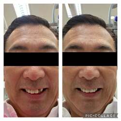  堀ちえみの夫、前歯が取れてしまい慌てて病院へ「飛んで行きました」 