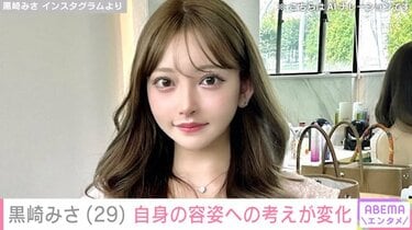 黒崎みさの整形総額と施術箇所の全貌!昔の写真比較と離婚・双子出産を経て辿り着いた現在のリアル