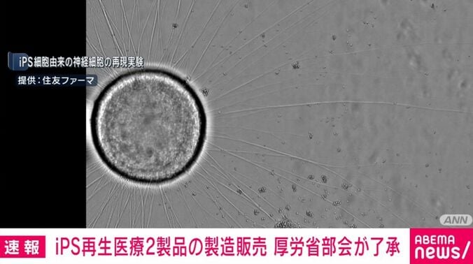 iPS細胞由来の神経細胞の再現実験