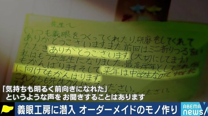 「義眼で人生が変わった」「片目が見えるじゃないかと言われ、障害者として認めてもらえない」…当事者たちに聞いた「片目失明」のリアル 4枚目