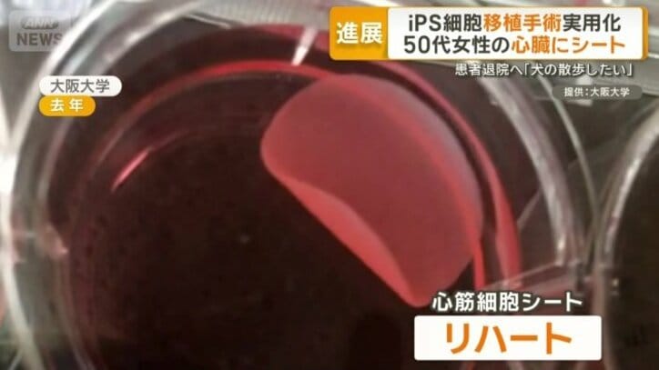 ぴくぴくと動く薄いシートが「リハート」