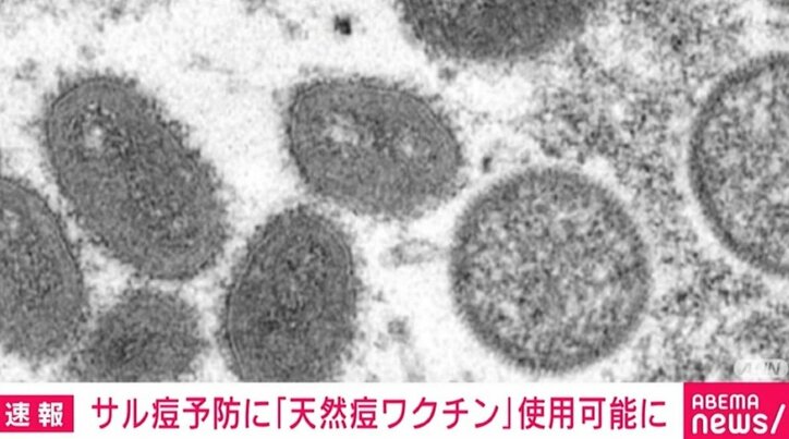 「サル痘」予防に天然痘のワクチンを使用可能に 厚労省の専門部会で了承
