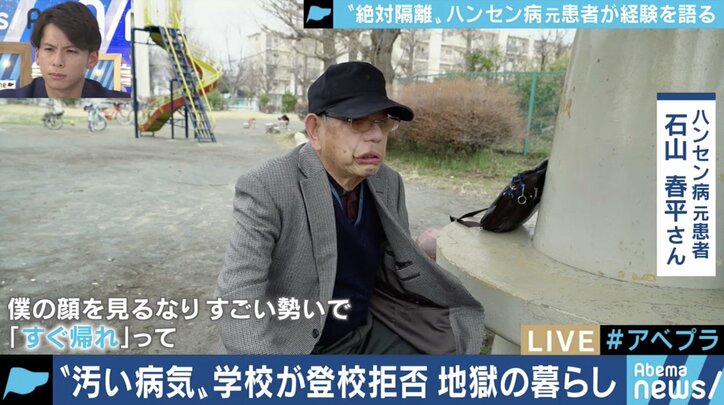 「二度と学校に来るな」と教師に言われた小6の夏から70年…差別や偏見と闘い続けてきたハンセン病回復者の半生