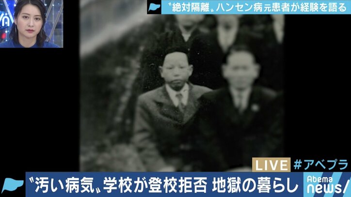 「二度と学校に来るな」と教師に言われた小6の夏から70年…差別や偏見と闘い続けてきたハンセン病回復者の半生