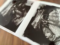 内山琴『妊娠してから⑨15w3d初お腹エコー』