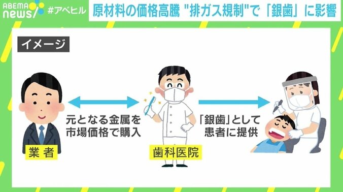 排ガス規制が「銀歯」に影響、原材料のパラジウムが高騰 「100万円前後の持ち出しも…」 5枚目