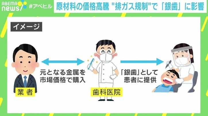 排ガス規制が「銀歯」に影響、原材料のパラジウムが高騰 「100万円前後の持ち出しも…」