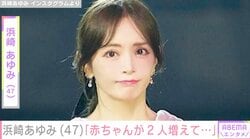 浜崎あゆみ（47）が保護犬2匹を迎え入れ「非常に複雑な手術が早期に必要なため、高度な技術を要する限られたドクターを探さなければならない状況だった」名付け親は長男