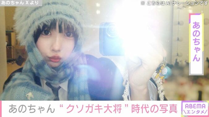 【写真・画像】あのちゃん、幼さ残る“クソガキ大将”時代の写真を公開「まあ可愛いクソガキなこと」「独り占めしたくなるほど超可愛い」と反響　1枚目