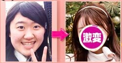 「元がもう残ってないよ！」1500万円で“アイドル顔”になった美女のビフォーアフターに驚きの声