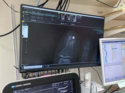 モデル・実業家の鈴木亜子、 エスカレーターを踏み外し転倒した結果「腫れてます」