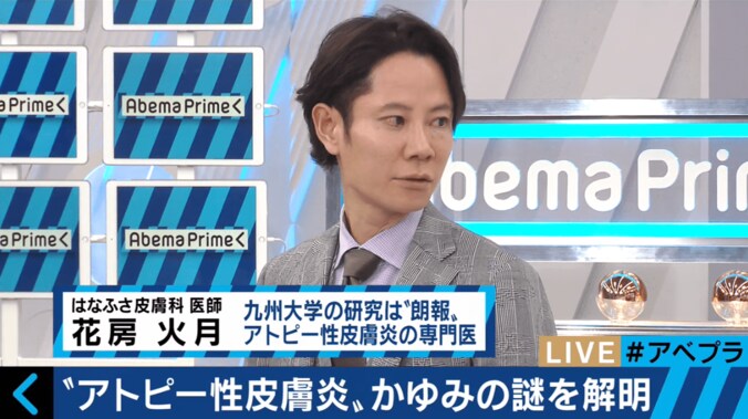 日本人の１割が患うアトピー性皮膚炎　“かゆみ”の治療に新たな道か 3枚目