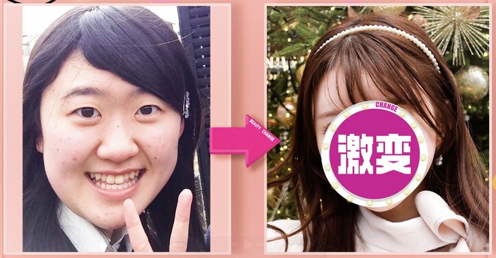 【写真・画像】「元がもうないよ！」1500万円でアイドル顔を手にいれた美女のビフォーアフターに驚きの声　1枚目