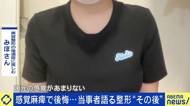 「口元の感覚がなくなって…」美容整形後のリスク “後遺症”患者増加に医師が警鐘