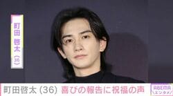 “タトゥー”が話題・町田啓太（36）、幼少期ショットが「突出して可愛い」と反響