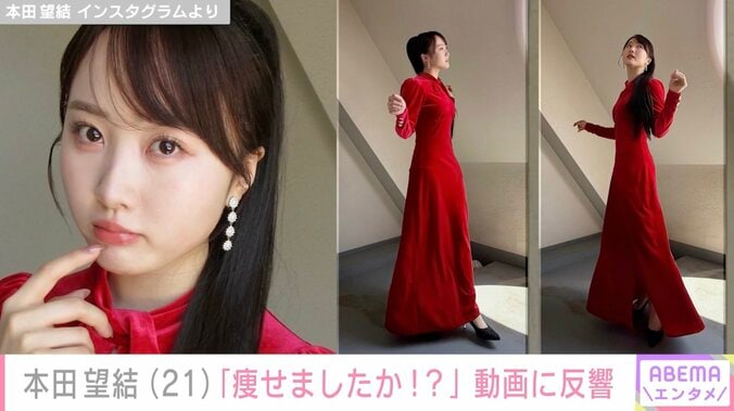 “10kg減”を公表した本田望結（21）、近影に「すっぴん？」「痩せましたか!?」「国宝級のかわいさ」など様々な反響 3枚目