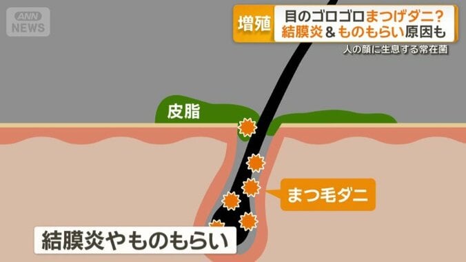 結膜炎やものもらいなどの原因になることも