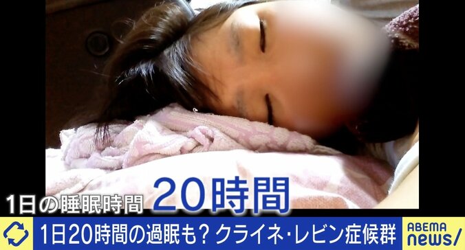 1日20時間の過眠…幼児化や過食も 「クライネ・レビン症候群」当事者と夫に聞く日常生活への影響 1枚目