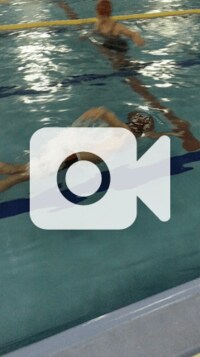 金子エミ『ダウン症の子の頚椎の不安定性に気をつける』