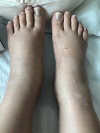 キンタロー。『足がメロンパンパン。』